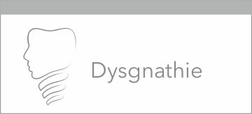 Dysgnathie