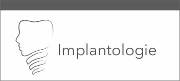 Implantologie in Köln